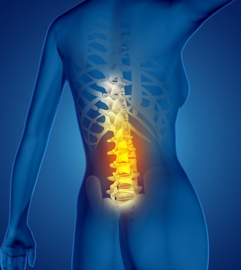 Slipped Disc Treatment in Singapore